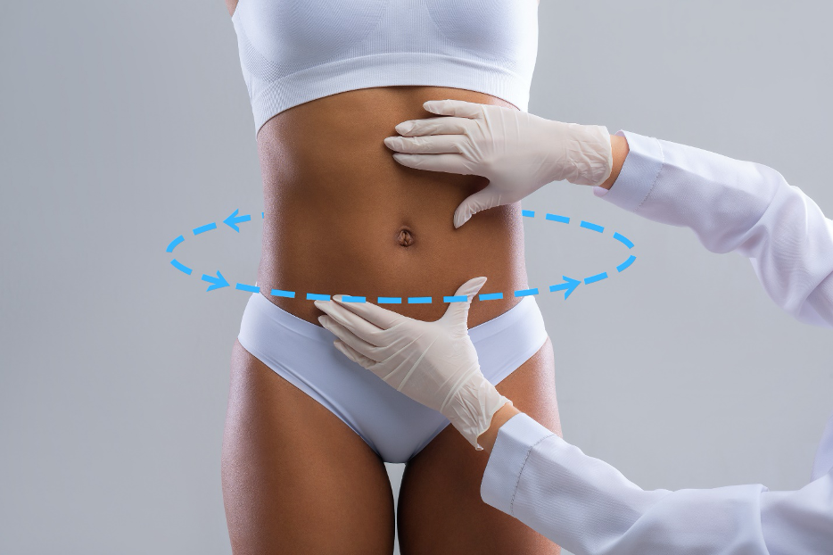 Liposuction Procedure, The Lett Center