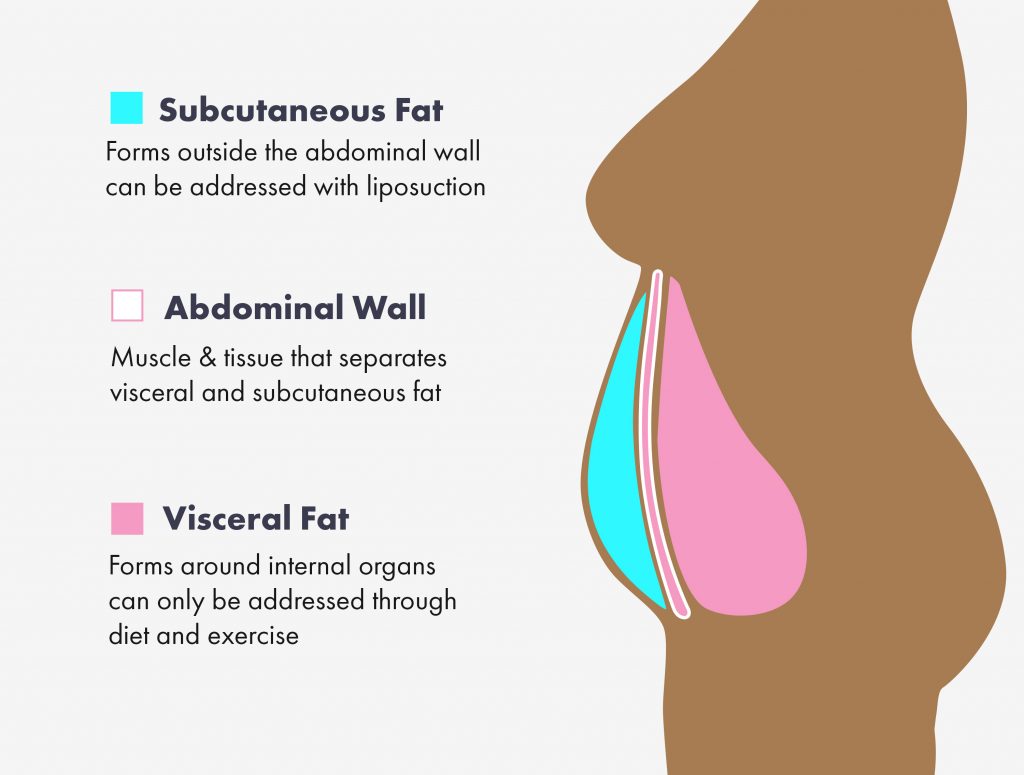 Subcutaneous fat and weight loss