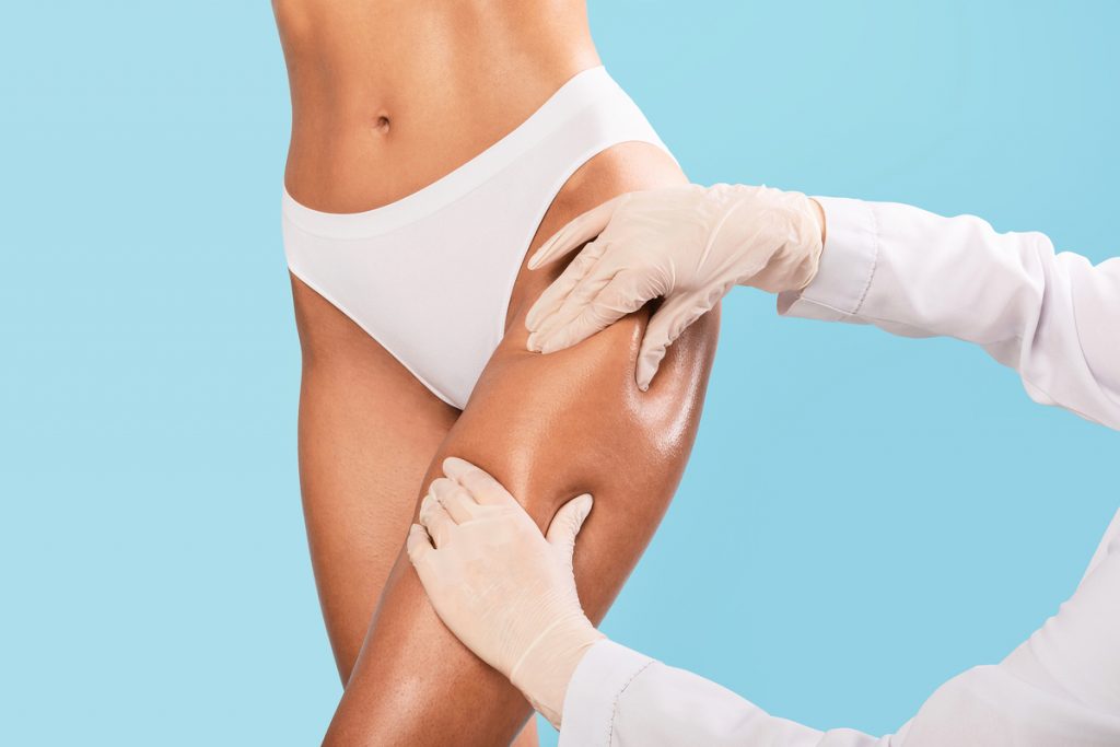 Ten common misconceptions about liposuction